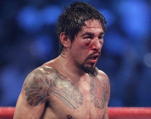 Margarito termin� con una fractura