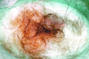 Todos los d�as se cae cabello, por lo regular 100 diarios en promedio, sin embargo, si la persona em