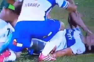 <b>Video.</b> Escalofriante fractura en el futbol chileno Marko Biskupovic sufri una dura entrada de Marco Sebastin Pol y sali fracturado.