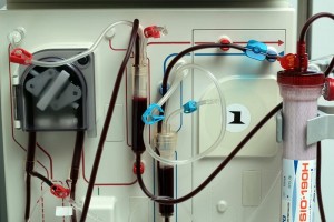 Diputados federales pidieron incluir el tratamiento a la insuficiencia renal cr�nica dentro del esqu