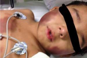 El traslado del menor se realiz� en un helic�ptero del escuadr�n a�reo Rel�mpago del gobierno estata