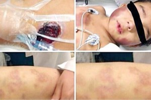 Aspecto del menor durante su hospitalizaci�n