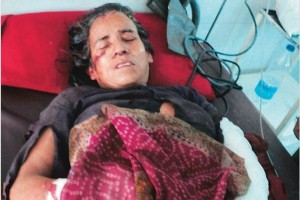 La mujer se recupera en un hospital del gobierno en la ciudad de Srinagar