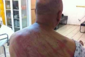 Reportan con dao cerebral a polica agredido por CETEG