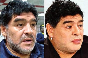 Critican a Maradona en todo el mundo por su operaci�n de rostro