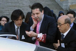 Atacan y lesionan a embajador de EU en Surcorea: medios La polica confirm que Lippert fue atacado y un sospechoso fue detenido y estaba siendo interrogado