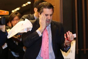 Condena EU ataque a embajador en Sel; no teme por su vida Las imgenes de televisin mostraron al embajador ensangrentado en la cabeza y el brazo aunque solo