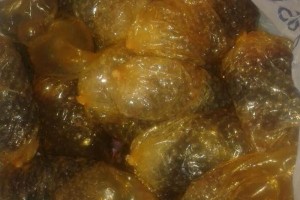 Tras una revisi�n, el personal m�dico encontr� que en el �rea abdominal ten�a objetos irreg